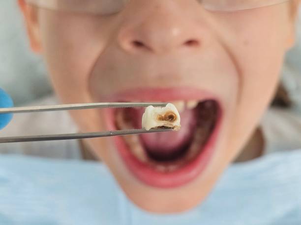 Best After-Hours Emergency Dentist in Selma, TX